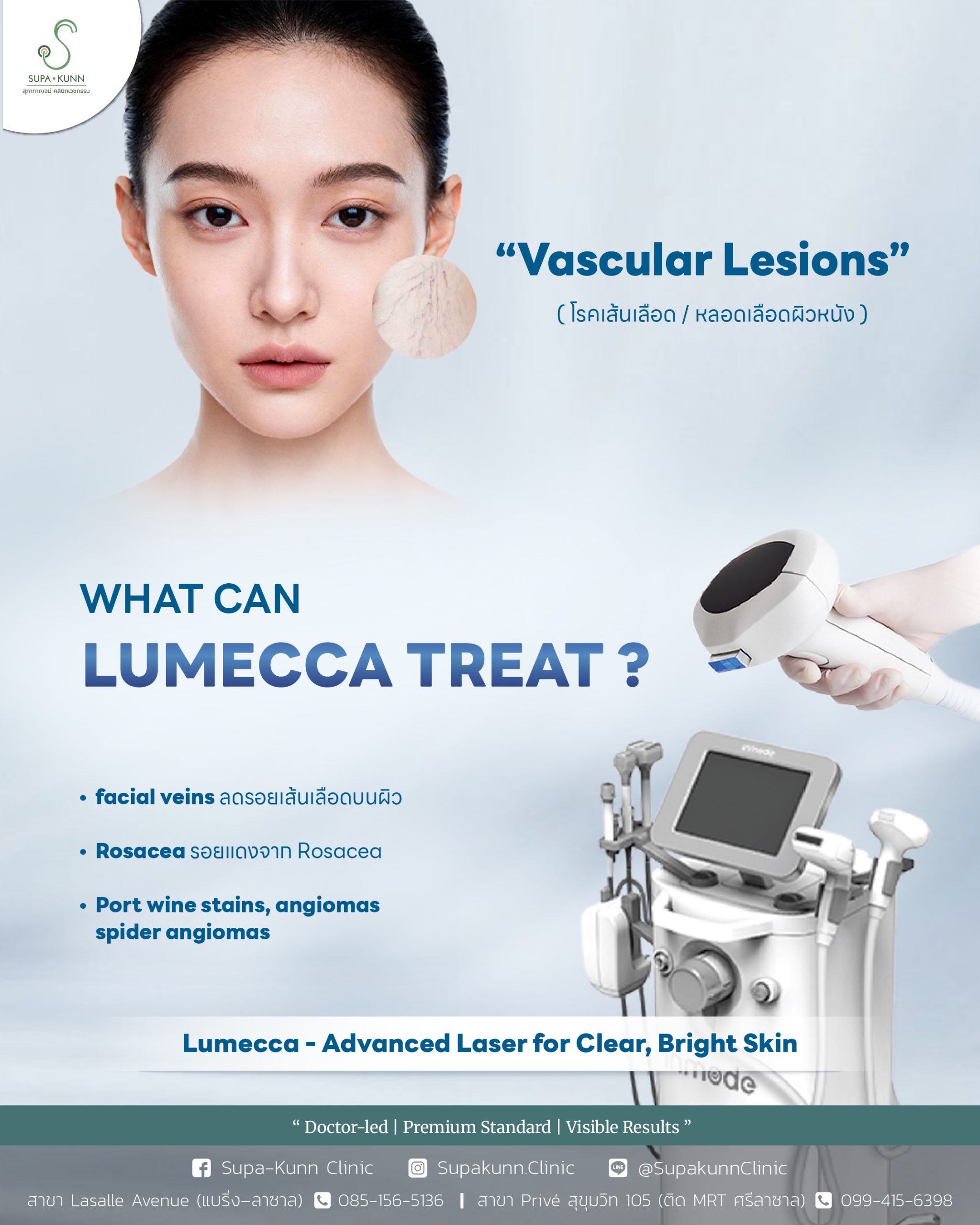 15 lumecca-02